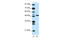 ETS Variant 5 antibody, 27-534, ProSci, Enzyme Linked Immunosorbent Assay image 
