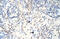 Zinc Finger Protein 875 antibody, 29-177, ProSci, Western Blot image 