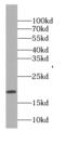 G Antigen 8 antibody, FNab03299, FineTest, Western Blot image 