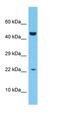 Zinc Finger Protein 576 antibody, orb324579, Biorbyt, Western Blot image 