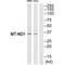 Mitochondrially Encoded NADH:Ubiquinone Oxidoreductase Core Subunit 1 antibody, A02292, Boster Biological Technology, Western Blot image 