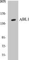 ABL Proto-Oncogene 1, Non-Receptor Tyrosine Kinase antibody, EKC1012, Boster Biological Technology, Western Blot image 