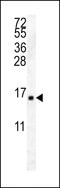 Histone Cluster 2 H2A Family Member A4 antibody, 57-382, ProSci, Western Blot image 