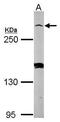 Phosphodiesterase 4D Interacting Protein antibody, PA5-30324, Invitrogen Antibodies, Western Blot image 