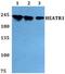 HEAT Repeat Containing 1 antibody, A11299, Boster Biological Technology, Western Blot image 
