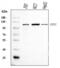 Endoplasmic Reticulum To Nucleus Signaling 2 antibody, A05659-2, Boster Biological Technology, Western Blot image 