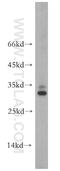 Secretogranin V antibody, 10761-1-AP, Proteintech Group, Western Blot image 