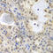 Minichromosome Maintenance Complex Component 3 antibody, A1060, ABclonal Technology, Immunohistochemistry paraffin image 