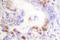 FA Complementation Group D2 antibody, LS-C176017, Lifespan Biosciences, Immunohistochemistry paraffin image 