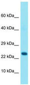 GRB2 Related Adaptor Protein antibody, TA337331, Origene, Western Blot image 