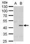 DNA repair protein XRCC3 antibody, PA5-21280, Invitrogen Antibodies, Western Blot image 