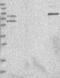Chromosome 6 Open Reading Frame 118 antibody, NBP1-88727, Novus Biologicals, Western Blot image 