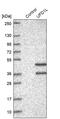 Ubiquitin Recognition Factor In ER Associated Degradation 1 antibody, PA5-56427, Invitrogen Antibodies, Western Blot image 