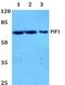 PIF1 5'-To-3' DNA Helicase antibody, PA5-37136, Invitrogen Antibodies, Western Blot image 