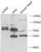 CCCTC-Binding Factor Like antibody, FNab10392, FineTest, Western Blot image 