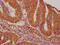 Vasorin antibody, CSB-PA025796OA01HU, Cusabio, Immunohistochemistry paraffin image 