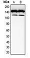 c-Kit antibody, orb214162, Biorbyt, Western Blot image 