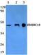 Zinc Finger DHHC-Type Containing 18 antibody, A15025, Boster Biological Technology, Western Blot image 