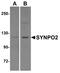 Synaptopodin 2 antibody, A07616, Boster Biological Technology, Western Blot image 