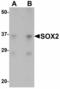 Quiescin Sulfhydryl Oxidase 1 antibody, LS-C108535, Lifespan Biosciences, Western Blot image 