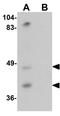 Transmembrane Serine Protease 11A antibody, GTX32036, GeneTex, Western Blot image 
