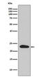 Synaptosome Associated Protein 23 antibody, M02487-1, Boster Biological Technology, Western Blot image 