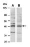 NSE2 (MMS21) Homolog, SMC5-SMC6 Complex SUMO Ligase antibody, orb67031, Biorbyt, Western Blot image 