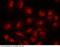 Progesterone Receptor antibody, 100362-T10, Sino Biological, Immunohistochemistry paraffin image 
