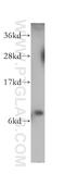 S100 Calcium Binding Protein P antibody, 11803-1-AP, Proteintech Group, Western Blot image 
