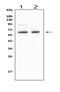 Bridging Integrator 1 antibody, MA1005, Boster Biological Technology, Western Blot image 