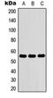 Zinc Finger Protein 76 antibody, orb304673, Biorbyt, Western Blot image 