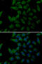 Procollagen-lysine,2-oxoglutarate 5-dioxygenase 2 antibody, 15-341, ProSci, Immunofluorescence image 