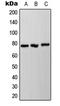 NADH:Ubiquinone Oxidoreductase Core Subunit S1 antibody, LS-C352563, Lifespan Biosciences, Western Blot image 