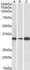 Microtubule Associated Protein RP/EB Family Member 3 antibody, orb20476, Biorbyt, Western Blot image 
