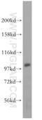 AP1B1 antibody, 16932-1-AP, Proteintech Group, Western Blot image 