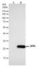 Sepiapterin Reductase antibody, PA5-22293, Invitrogen Antibodies, Immunoprecipitation image 