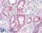 Tyrosine Kinase 2 antibody, LS-B1491, Lifespan Biosciences, Immunohistochemistry paraffin image 