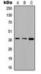 Aldolase, Fructose-Bisphosphate C antibody, LS-C354525, Lifespan Biosciences, Western Blot image 