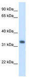 Hydroxymethylglutaryl-CoA lyase, mitochondrial antibody, TA346165, Origene, Western Blot image 