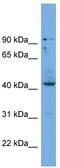 Homeobox protein Hox-B3 antibody, TA344488, Origene, Western Blot image 