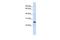 Reticulon 1 antibody, GTX46033, GeneTex, Western Blot image 