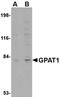 Glycerol-3-Phosphate Acyltransferase, Mitochondrial antibody, orb74993, Biorbyt, Western Blot image 