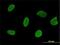 Ribosomal L24 Domain Containing 1 antibody, H00051187-M01, Novus Biologicals, Immunocytochemistry image 