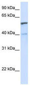 UDP Glucuronosyltransferase Family 1 Member A6 antibody, TA346069, Origene, Western Blot image 