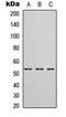 3-Hydroxyisobutyrate Dehydrogenase antibody, LS-C356093, Lifespan Biosciences, Western Blot image 