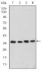 Cyclin Dependent Kinase 5 antibody, GTX60441, GeneTex, Western Blot image 