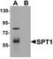 Serine Palmitoyltransferase Long Chain Base Subunit 1 antibody, LS-C144369, Lifespan Biosciences, Western Blot image 