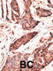 2'-5'-Oligoadenylate Synthetase Like antibody, A04123-1, Boster Biological Technology, Immunohistochemistry paraffin image 