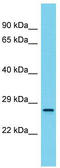 RAS Related antibody, TA345135, Origene, Western Blot image 