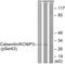 Calsenilin antibody, LS-C198717, Lifespan Biosciences, Western Blot image 